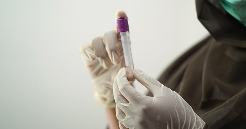 AB test : la méthode simple pour booster vos conversions